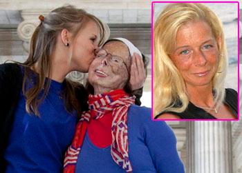 //patricia lefranc acid attack getty