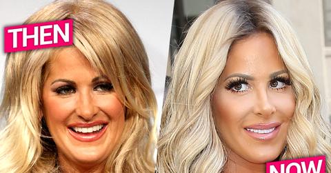 Kim Zolciak Nose Job