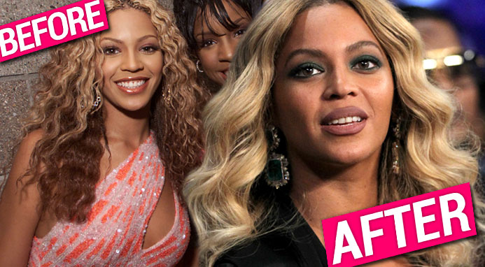 Pretty Hurts? Top Doc Claims Beyonce Got New Nose, Lips & More!