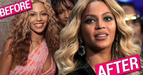 Beyonce Plastic Surgery