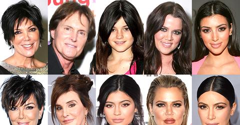 Kim Kardashian Kylie Jenner KUWTK Plastic Surgery