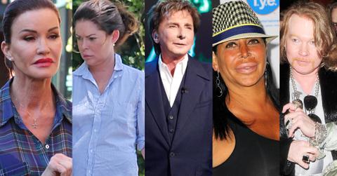 //most shocking plastic surgery transformations