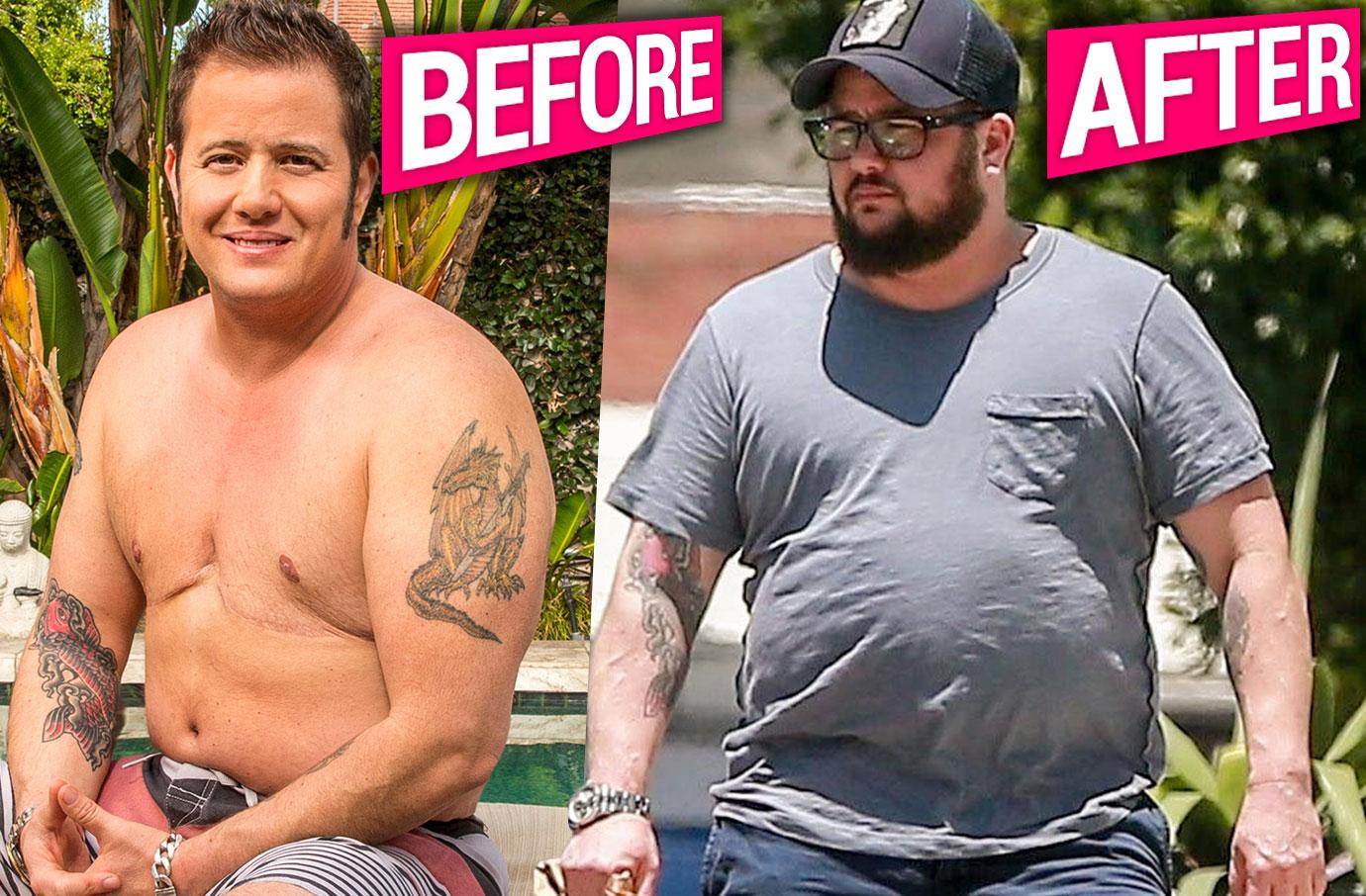 Chaz Bono – Cher’s Kid’s Extreme Weight Loss And Gains Are Killing Him