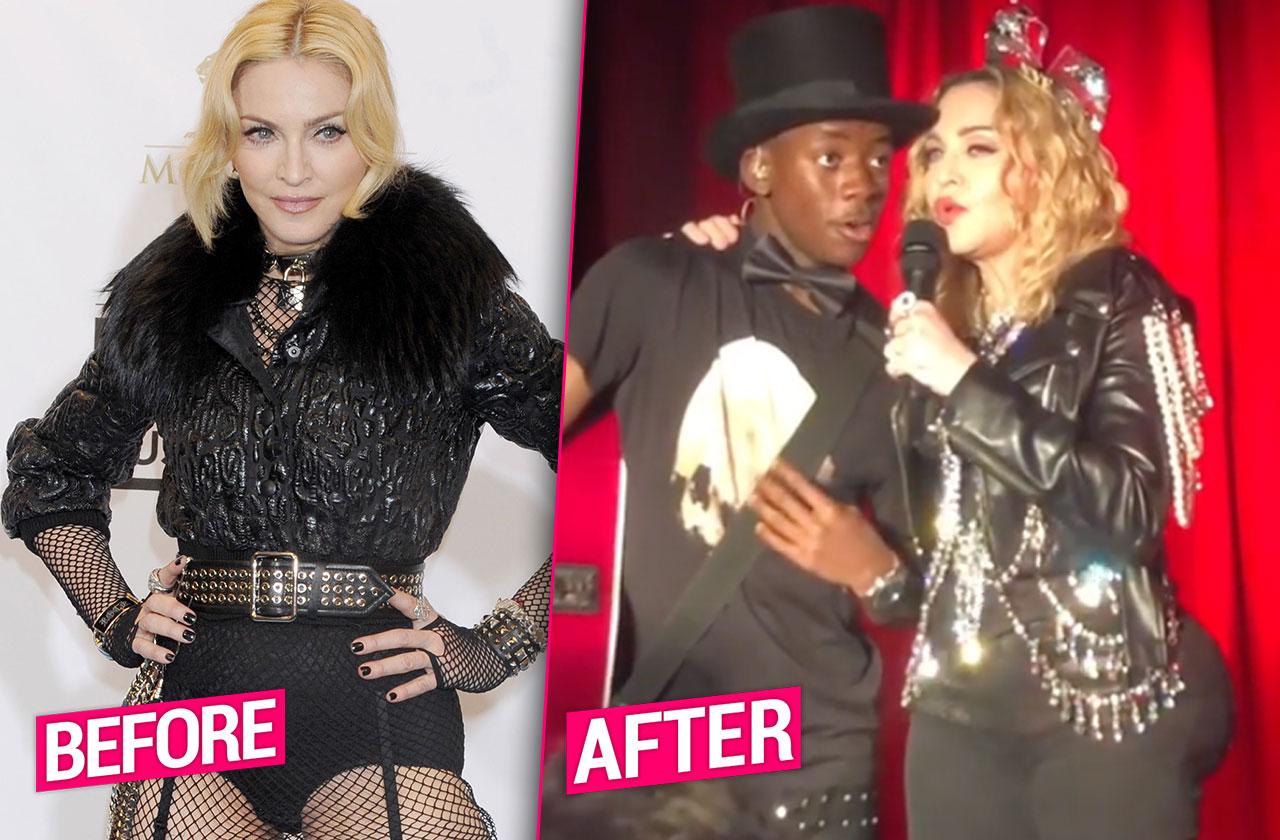 Madonna Butt Injections New Year's Eve Concert