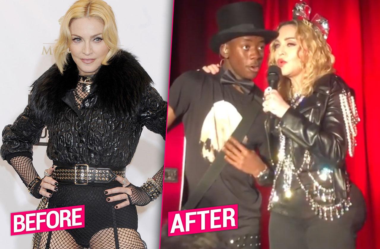 Madonna Shows Off Huge Butt, Sparks Rumors She Got Butt Implants(00)
