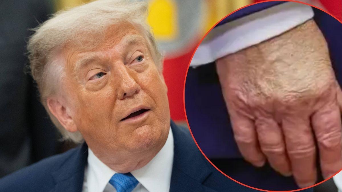 Photo of Donald Trump