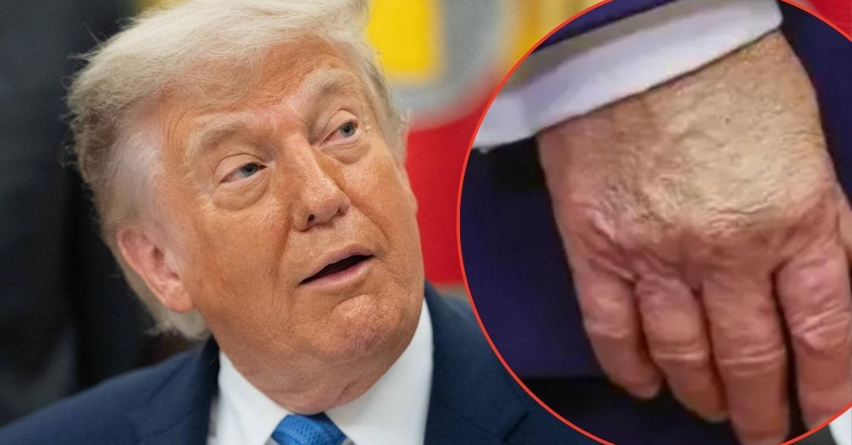 Radar Reveals Everything to Know About Donald Trump's Health — As Concerns Over the Prez's Well-Being Ramps Up