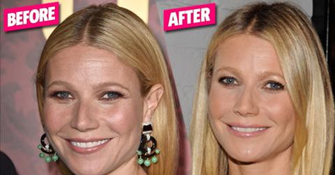 Gwyneth Paltrow Plastic Surgery Revealed