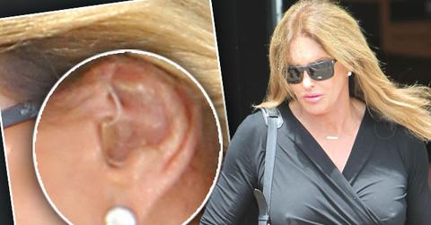 Caitlyn Jenner Hearing Aid Photos