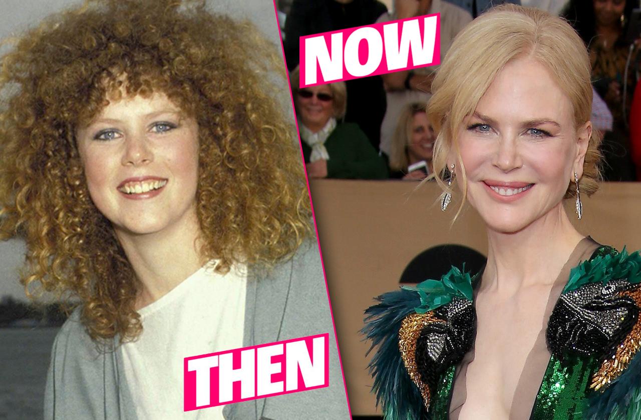 Nicole Kidman The Truth Behind Her Plastic Surgery Journey