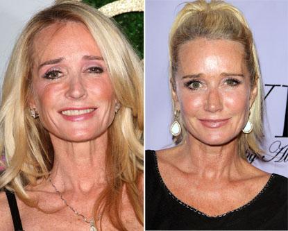 //kim richards nose job_ _