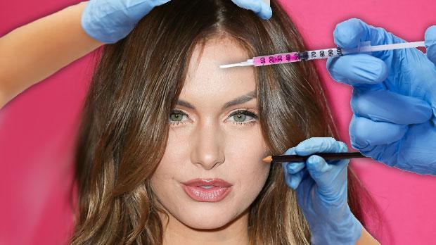 lala kent plastic surgery botox lips chin jawline vanderpump rules