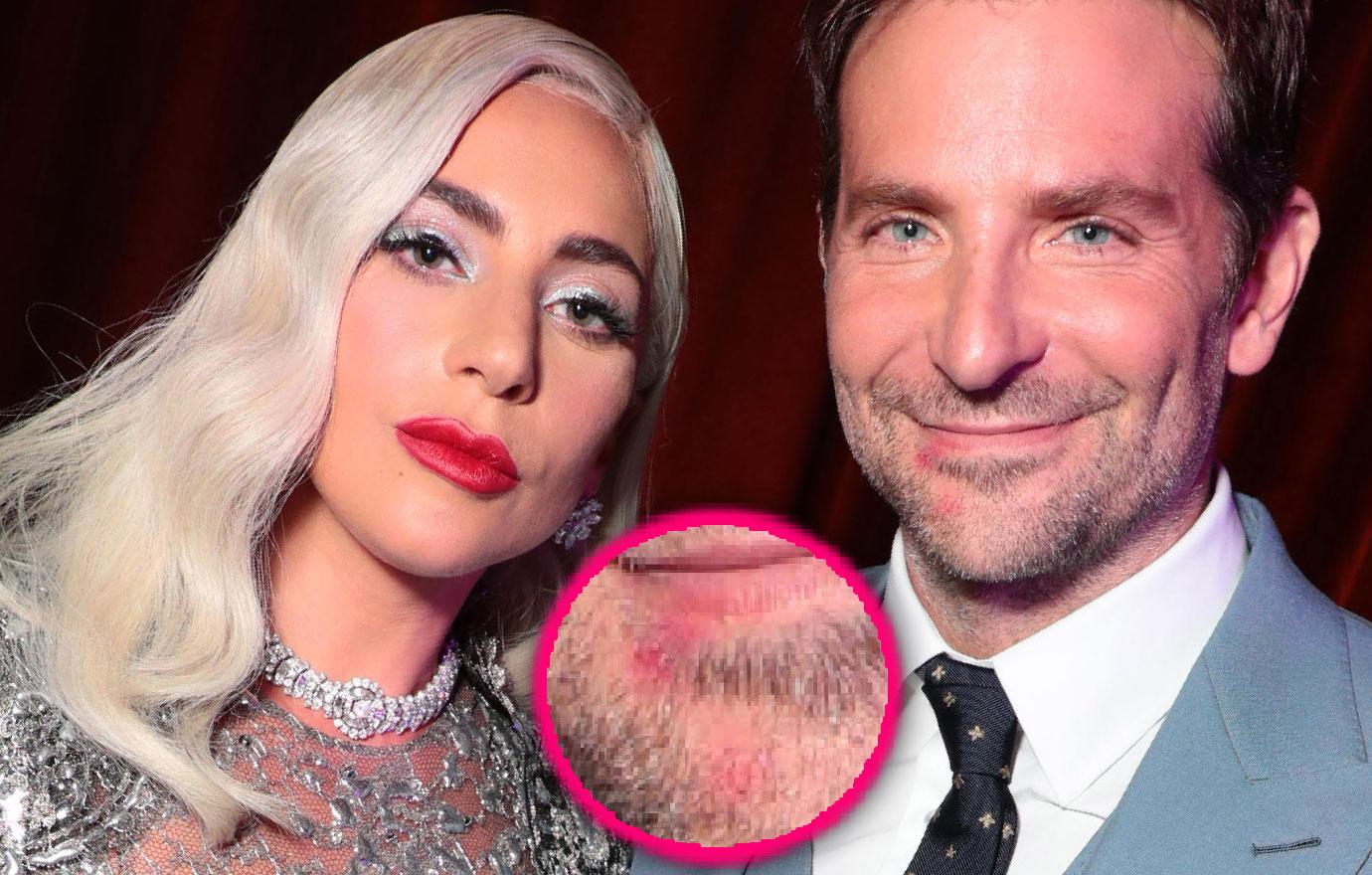 Lady Gaga S Lipstick Seen On Bradley Cooper S Mouth