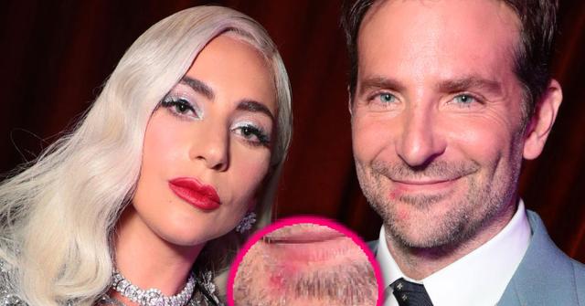 Lady Gaga's Lipstick Seen On Bradley Cooper's Mouth