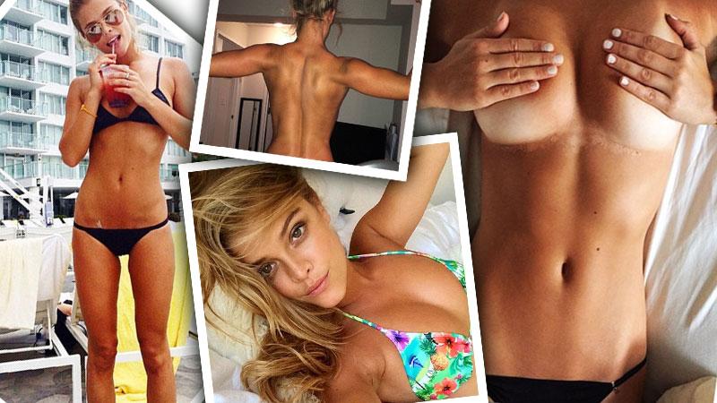 Sexiest Sunburn Ever! Peeling Nina Agdal Covers Breasts With Hands