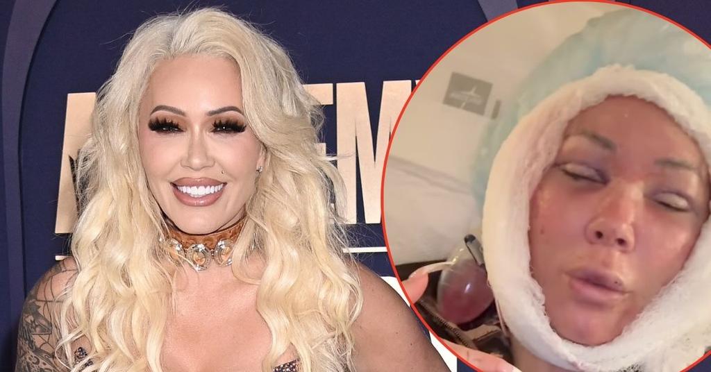 Bunnie Xo Reveals Graphic BeforeandAfter Following a Facelift