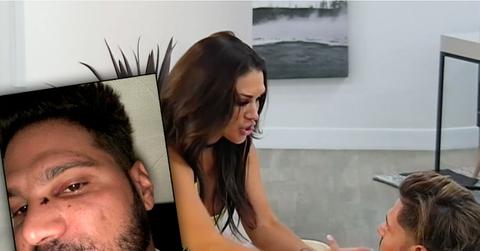 Ronnie Ortiz-Magro’s Face Bloodied After Alleged Fight With Girlfriend Jen Harley