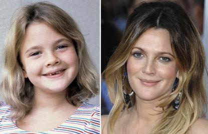 //drew barrymore child star plastic surgery