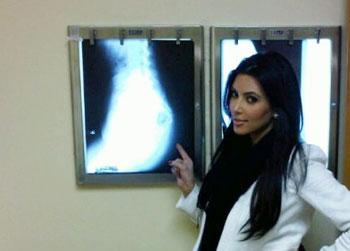 //kim_butt_xray_ _www khloekardashian celebuzz com