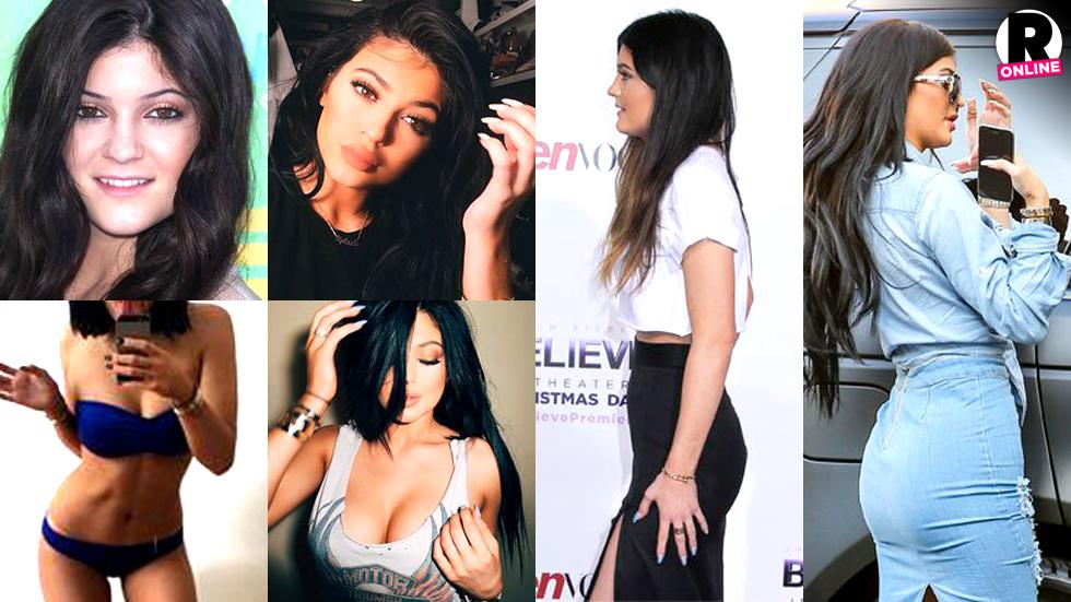 Kylie Jenner Plastic Surgery