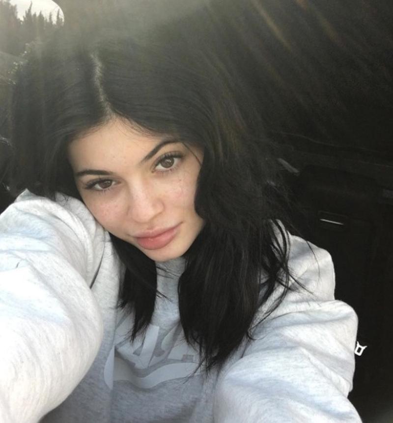 Kylie Jenner Tyga Plastic Surgery Laser Treatment Center