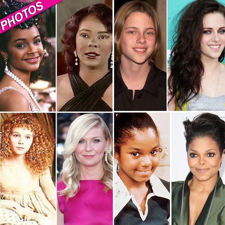 //celebrity plastic surgery post