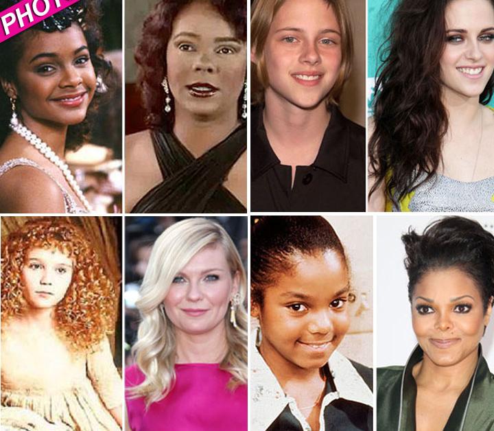 More Child Stars Who’ve Gone Under The Knife & More Who’ve Aged Naturally