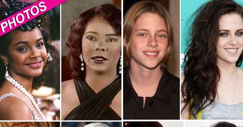 //celebrity plastic surgery post