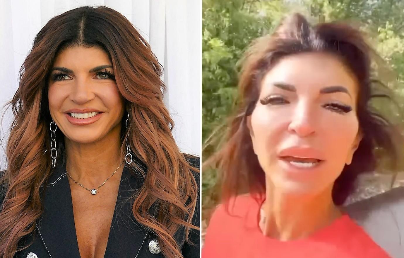 Teresa Giudice Looks Unrecognizable As Doctors Reveal What Plastic ...