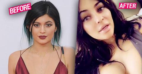 //Kylie Jenner Boob Job Breast Augmentation ppbIhd