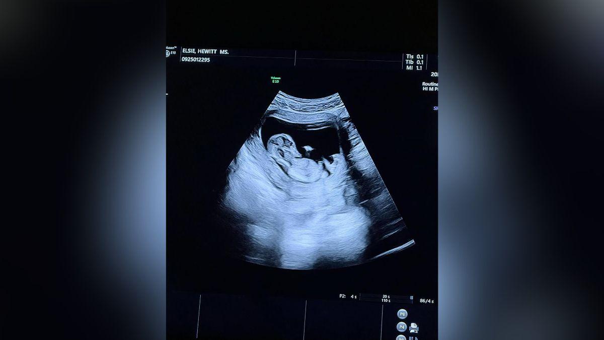 Pete Davidson and Elsie Hewitt share one child together.