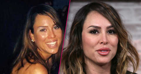 //Kelly Dodd Plastic Surgery Before After Photos pp