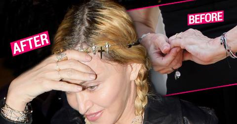 Madonna Plastic Surgery Hands Wrinkly