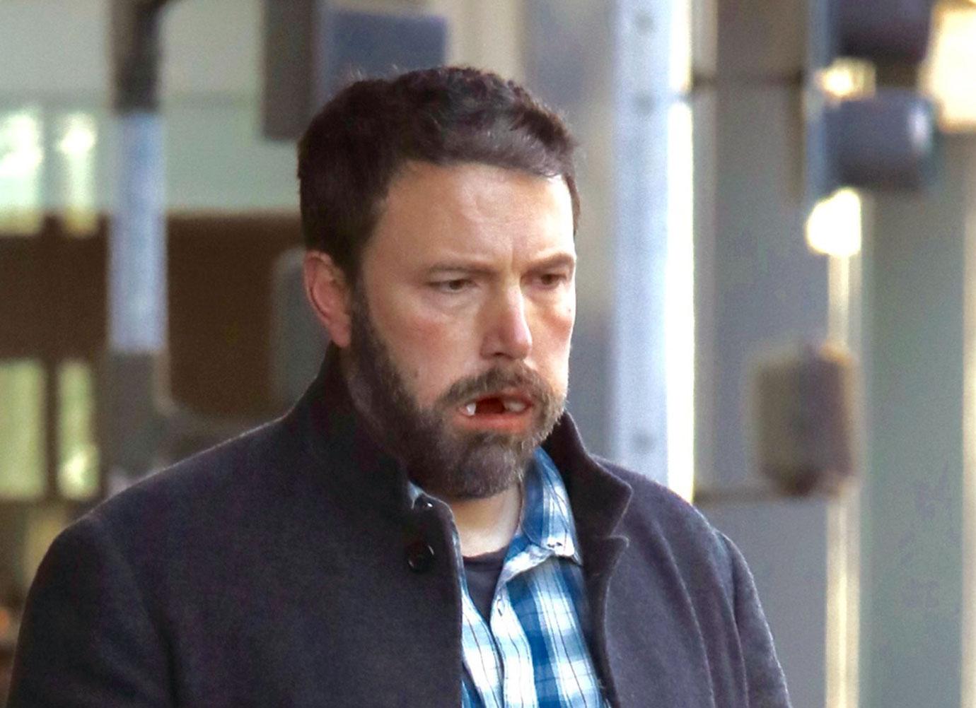 Ben Affleck Cotton Mouth Dental Surgery