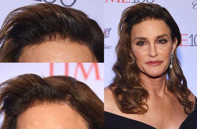 Caitlyn Jenner Hair Plugs Time Gala Photos