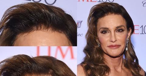 Caitlyn Jenner Hair Plugs Time Gala Photos