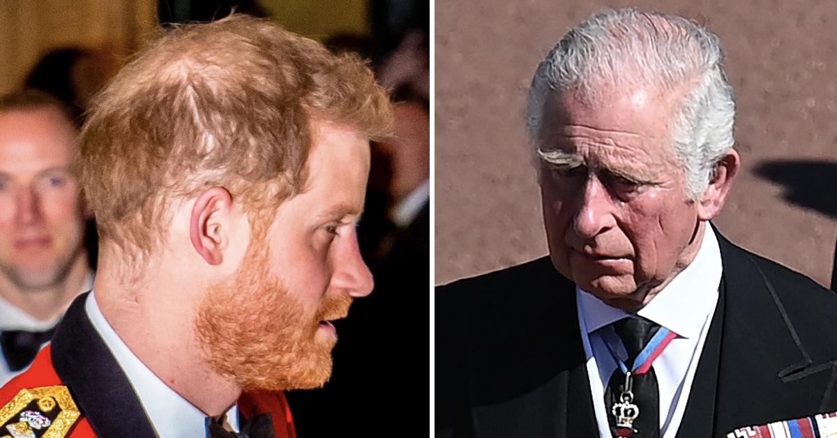 Prince Harry s Hair Loss Isn t Due To Stress Expert Blames Prince