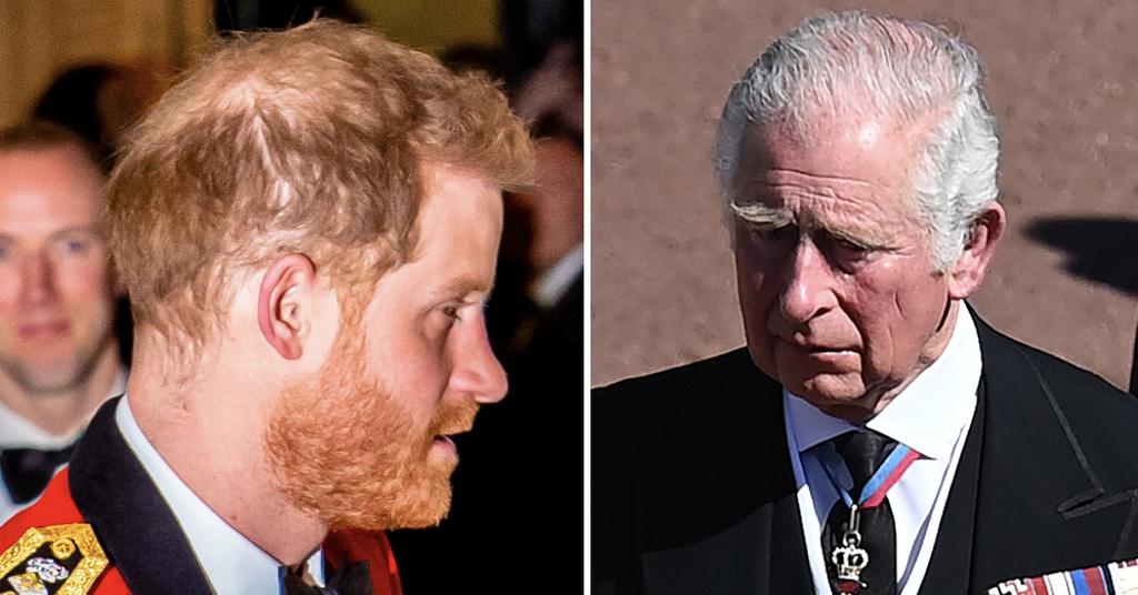 Prince Harry's Hair Loss Isn't Due To Stress, Expert Blames Prince Charles