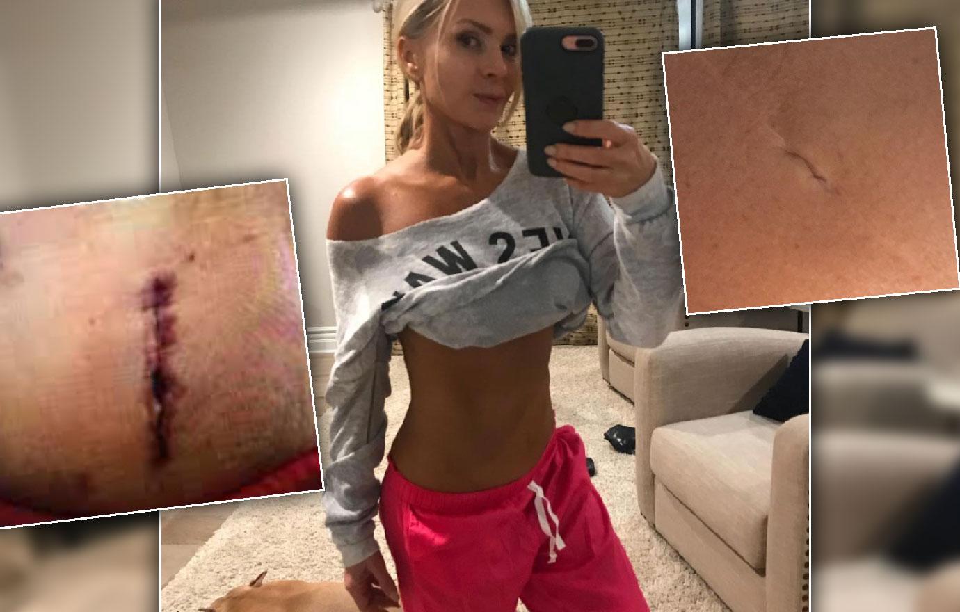 Tamra Judge Shows Off Belly Scar Spray Tan After Husband Eddie's Surgery