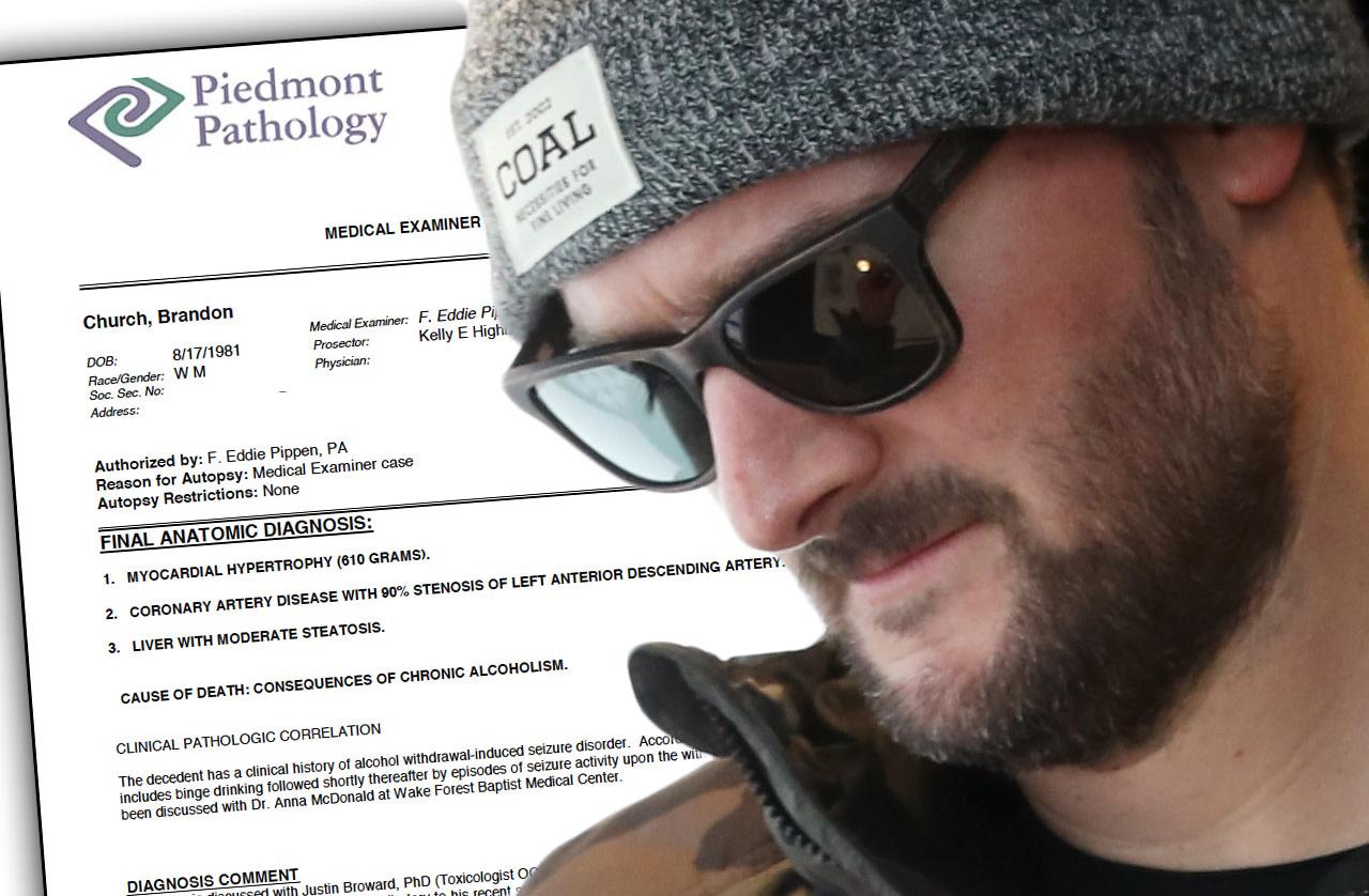 Eric Church's Brother Brandon's Autopsy Reveals Cause Of Death As