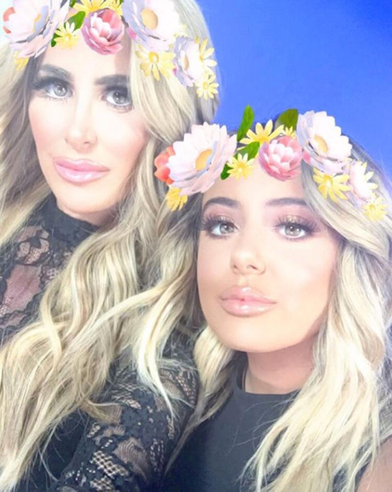 Kim And Brielle Zolciak Caught With Huge Lips After Plastic Surgeon Visit