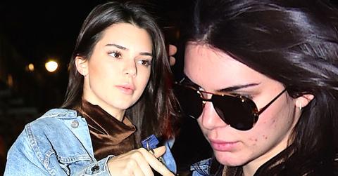 //kendall jenner no makeup acne breakout pp