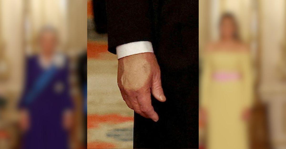 Photo of Donald Trump hand