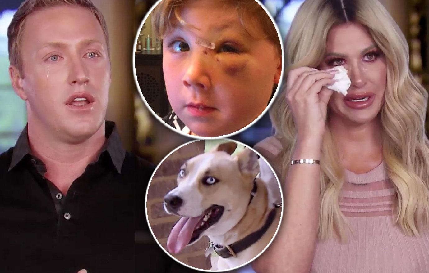 Kim Zolciak And Husband Face Dog Who Harmed Son Don't Be Tardy