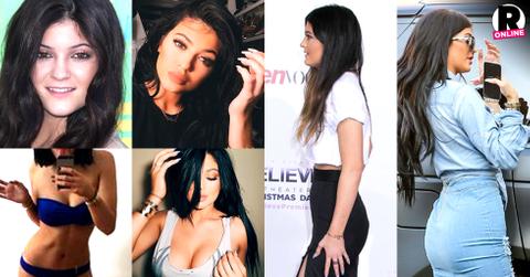 Kylie Jenner Plastic Surgery