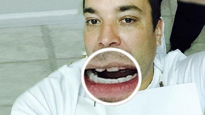 Another Injury Jimmy Fallon Chips Tooth