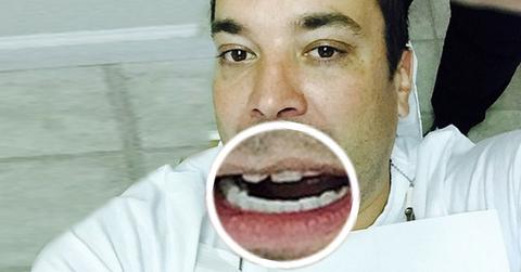 Another Injury Jimmy Fallon Chips Tooth
