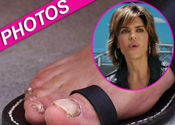 //lisa rinna funky foot toes