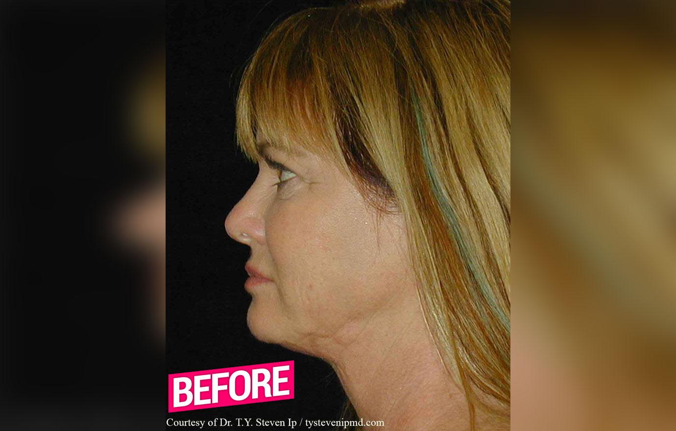 //rhoc Jeana Keough plastic surgery makeover