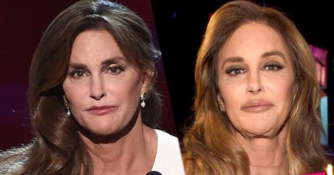 //caitlyn jenner plastic surgery lip fillers kylie jenner copycat